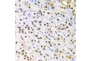 Immunohistochemistry of paraffin-embedded rat kidney using SFN Antibody. (14-3-3 sigma/SFN anticorps)