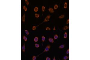 Immunofluorescence analysis of L929 cells using CCT6B antibody (ABIN7270709) at dilution of 1:100.