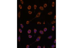 Immunofluorescence analysis of L929 cells using CCT6B antibody (ABIN7270709) at dilution of 1:100. (CCT6B anticorps  (AA 120-340))