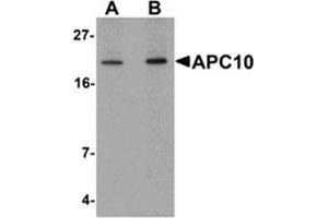Western blot analysis of APC10 in mouse heart tissue lysate with APC10 antibody at (A) 1 and (B) 2 μg/ml. (ANAPC10 anticorps  (Center))