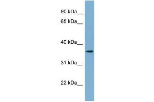 WB Suggested Anti-C1orf75 Antibody Titration:  0. (TMEM206 anticorps  (N-Term))