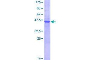 Image no. 1 for V-Set and Transmembrane Domain Containing 1 (VSTM1) (AA 1-174) protein (GST tag) (ABIN1325124)