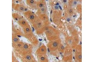 Used in DAB staining on fromalin fixed paraffin-embedded liver tissue (TOR1A anticorps  (AA 41-333))