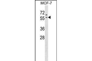 ZN Antibody (N-term) (ABIN1538932 and ABIN2849449) western blot analysis in MCF-7 cell line lysates (35 μg/lane). (ZNF383 anticorps  (N-Term))