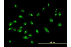 Immunofluorescence of purified MaxPab antibody to GORASP2 on HeLa cell. (GORASP2 anticorps  (AA 1-452))