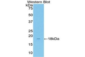 Western Blotting (WB) image for anti-Solute Carrier Family 12 (Sodium/Chloride Transporters), Member 3 (SLC12A3) (AA 3-146) antibody (ABIN2118607) (SLC12A3 anticorps  (AA 3-146))