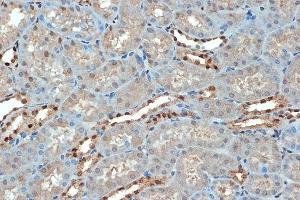 Immunohistochemistry of paraffin-embedded mouse kidney using SUMO4 Rabbit mAb (ABIN7270372) at dilution of 1:100 (40x lens).