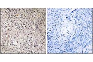 Immunohistochemistry analysis of paraffin-embedded human ovary tissue, using GCNT7 Antibody.