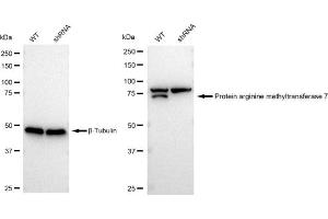 Western blotting analysis using Protein arginine methyltransferase 7 antibody (ABIN7799973).