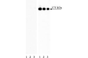 Western Blotting (WB) image for anti-Epidermal Growth Factor Receptor (EGFR) (pTyr845) antibody (ABIN967602) (EGFR anticorps  (pTyr845))