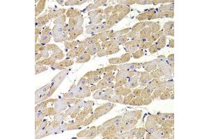 Immunohistochemistry of paraffin-embedded rat heart using FIS1 Antibody.