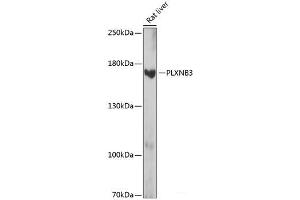Western blot analysis of extracts of Rat liver using PLXNB3 Polyclonal Antibody at dilution of 1:1000. (Plexin B3 anticorps)
