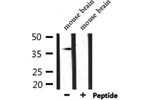 Western blot analysis of extracts from mouse brain, using AKR1C3 Antibody.