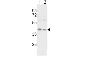 Western Blotting (WB) image for anti-Phosphoglycerate Kinase 1 (PGK1) antibody (ABIN3002985) (PGK1 anticorps)