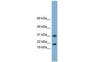 Image no. 1 for anti-Eukaryotic Translation Initiation Factor 5A2 (EIF5A2) (N-Term) antibody (ABIN6744192) (EIF5A2 anticorps  (N-Term))