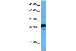 Host:  Rat  Target Name:  MAFG  Sample Tissue:  Rat Skeletal Muscle  Antibody Dilution:  1ug/ml (Mafg anticorps  (N-Term))