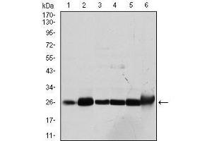 Western blot analysis using GSTM1 mouse mAb against Cos7 (1), MCF-7 (2), Jurkat (3), Hela (4), HL7702 (5) and HepG2 (6) cell lysate. (GSTM1 anticorps)