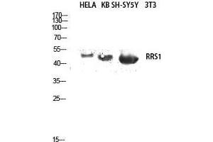 Western Blot (WB) analysis of HeLa, KB, SH-SY5Y lysis using RRS1 antibody.