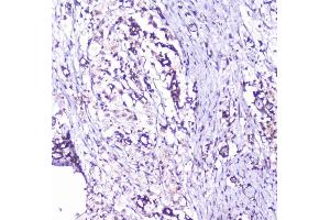 IHC analysis of cortactin using anti-cortactin antibody (ABIN6719306). (Cortactin anticorps  (AA 1-105))