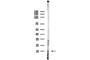 anti-Eukaryotic Translation Initiation Factor 4E Binding Protein 1 (EIF4EBP1) (pSer65), (pThr70) antibody