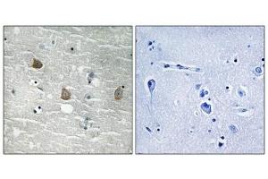Immunohistochemical analysis of paraffin-embedded human brain tissue using TOB1 (Phospho-Ser164) antibody (left)or the same antibody preincubated with blocking peptide (right). (Protein Tob1 (TOB1) (pSer164) anticorps)