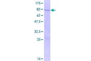 Image no. 1 for Semenogelin I (SEMG1) (AA 1-402) protein (GST tag) (ABIN1319502)