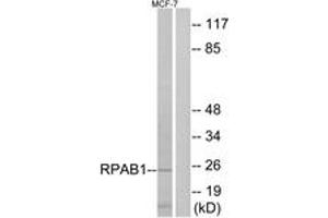 Western blot analysis of extracts from MCF-7 cells, using RPAB1 Antibody. (POLR2E anticorps  (AA 21-70))