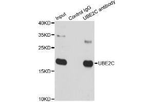 Immunoprecipitation analysis of 150 μg extracts of SW620 cells using 3 μg UBE2C antibody (ABIN5973207). (UBE2C anticorps)