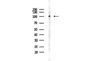 anti-Catenin (Cadherin-Associated Protein), alpha 1, 102kDa (CTNNA1) (C-Term) antibody