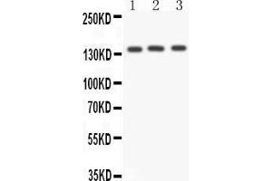 Anti- ACE antibody,  Western blotting All lanes: Anti ACE () at 0. (Angiotensin I Converting Enzyme 1 anticorps  (Middle Region))