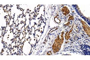 Detection of TLR5 in Rat Lung Tissue using Polyclonal Antibody to Toll Like Receptor 5 (TLR5)