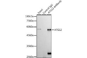 Immunoprecipitation analysis of 300 μg extracts of 293T cells using 3 μg  antibody (ABIN7265788). (ATG12 anticorps)