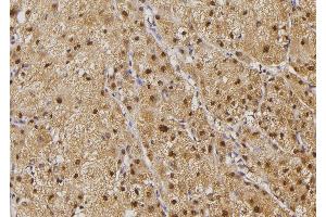 ABIN6274503 at 1/100 staining Human liver tissue by IHC-P. (ILKAP anticorps  (N-Term))