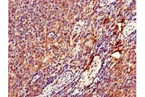 Immunohistochemistry of paraffin-embedded human lymph node tissue using ABIN7149671 at dilution of 1:100 (DENND1C anticorps  (AA 601-801))