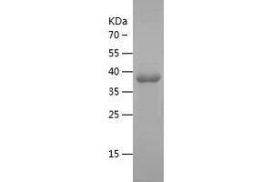 Western Blotting (WB) image for Neuroblastoma 1, DAN Family BMP Antagonist (NBL1) (AA 17-181) protein (His-IF2DI Tag) (ABIN7124146)