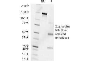 SDS-PAGE Analysis Purified Progesterone Mouse Monoclonal Antibody (6-5E-10B). (Progesterone anticorps)