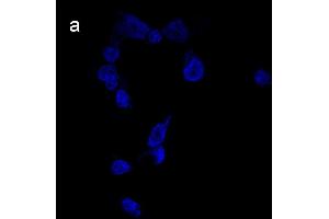 Detection of cathepsin B (CB) activity in Eca-109 cells by the CB probe. (Chèvre anti-Lapin IgG Anticorps (FITC))