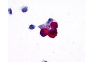 Anti-NPY5R antibody immunocytochemistry (ICC) staining of HEK293 human embryonic kidney cells transfected with NPY5R. (NPY5R anticorps  (Cytoplasmic Domain))