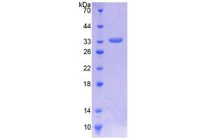 SDS-PAGE analysis of Human ILK Protein. (ILK Protéine)
