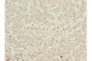 Immunohistochemistry of paraffin-embedded human liver tissue using ABIN7158391 at dilution of 1:100 (LHX6 anticorps  (AA 114-363))