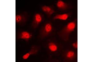 Immunofluorescent analysis of STAT1 (pS727) staining in NIH3T3 cells. (STAT1 anticorps  (C-Term, pSer727))