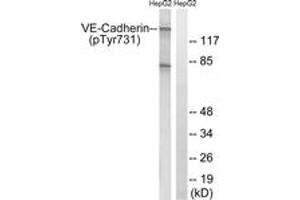 Western blot analysis of extracts from HepG2 cells treated with Na3VO4 0. (Cadherin 5 anticorps  (pTyr731))