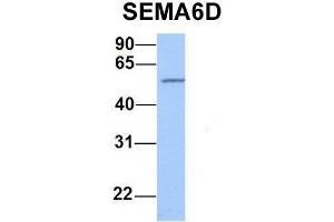 Host:  Rabbit  Target Name:  SEMA6D  Sample Type:  Human Fetal Heart  Antibody Dilution:  1.