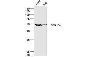 Lane 1: jurkat lysates Lane 2: raji lysates probed with ZCCHC4 Polyclonal Antibody, Unconjugated  at 1:300 dilution and 4˚C overnight incubation.