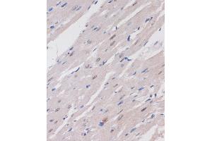 Immunohistochemistry of paraffin-embedded Rat heart using B Rabbit pAb (ABIN7265702) at dilution of 1:100 (40x lens). (ARID1B anticorps  (AA 400-650))