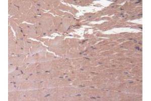 Detection of HMWK in Mouse Skeletal Muscle Tissue using Polyclonal Antibody to High Molecular Weight Kininogen (HMWK)