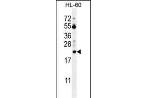 PT Antibody (N-term) (ABIN655715 and ABIN2845165) western blot analysis in HL-60 cell line lysates (35 μg/lane). (PTMA anticorps  (N-Term))