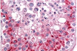 Human Testis: Formalin-Fixed, Paraffin-Embedded (FFPE)