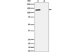 Western blot analysis of Phospho-p130(T986) expression in (1) Jurkat cell lysate, (2) Jurkat cell treated with phosphatase lysate.