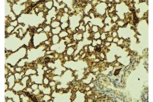 ABIN6269338 at 1/100 staining Mouse lung tissue by IHC-P. (FOXO1 anticorps  (Internal Region))